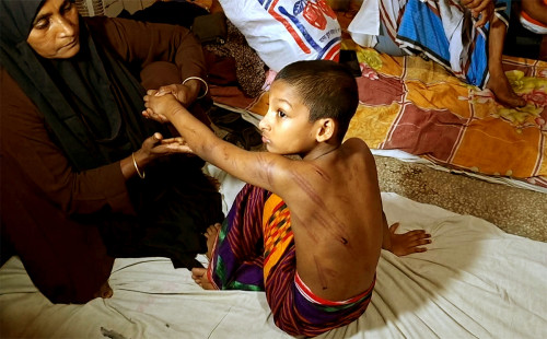 ৭ বছরের শিশুকে নির্মম প্রহার, মাদরাসা শিক্ষকের বিরুদ্ধে অভিযোগ 