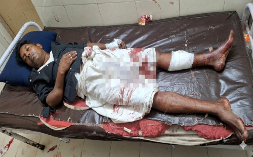 মিরসরাইয়ে রাতের আঁধারে হামলা, আহত কৃষক লীগ নেতা আলাউদ্দিন 