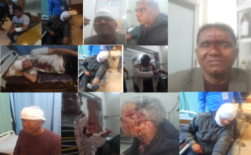 আত্মীয়ের জানাজা শেষে ফেরার পথে ডাকাতির কবলে প্রাইভেট কার, আহত ৫